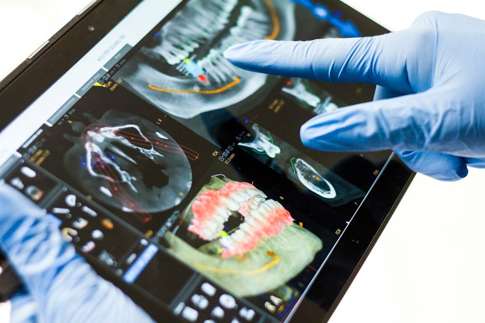 Revisión de un escáner dental en una tableta